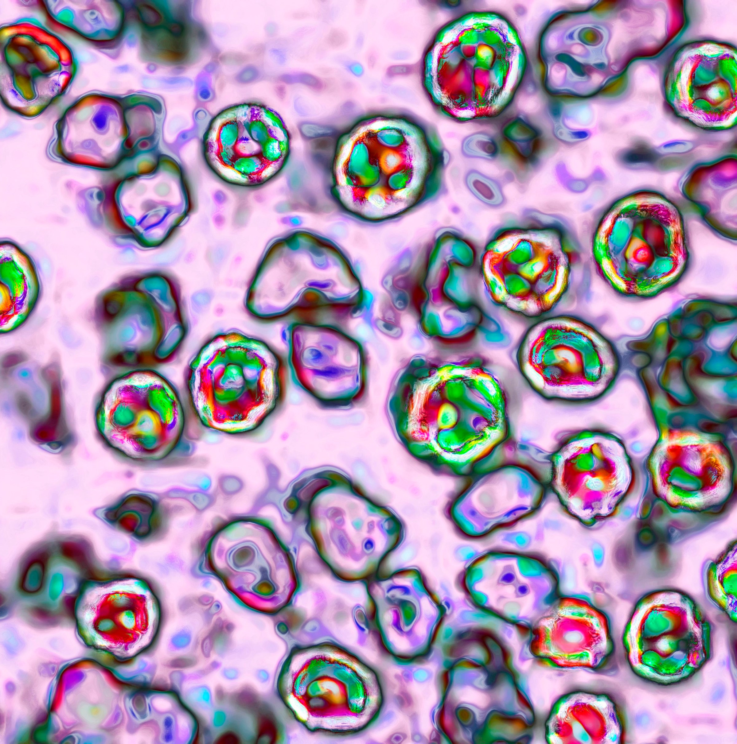 Can you still get measles even if you’ve been vaccinated?